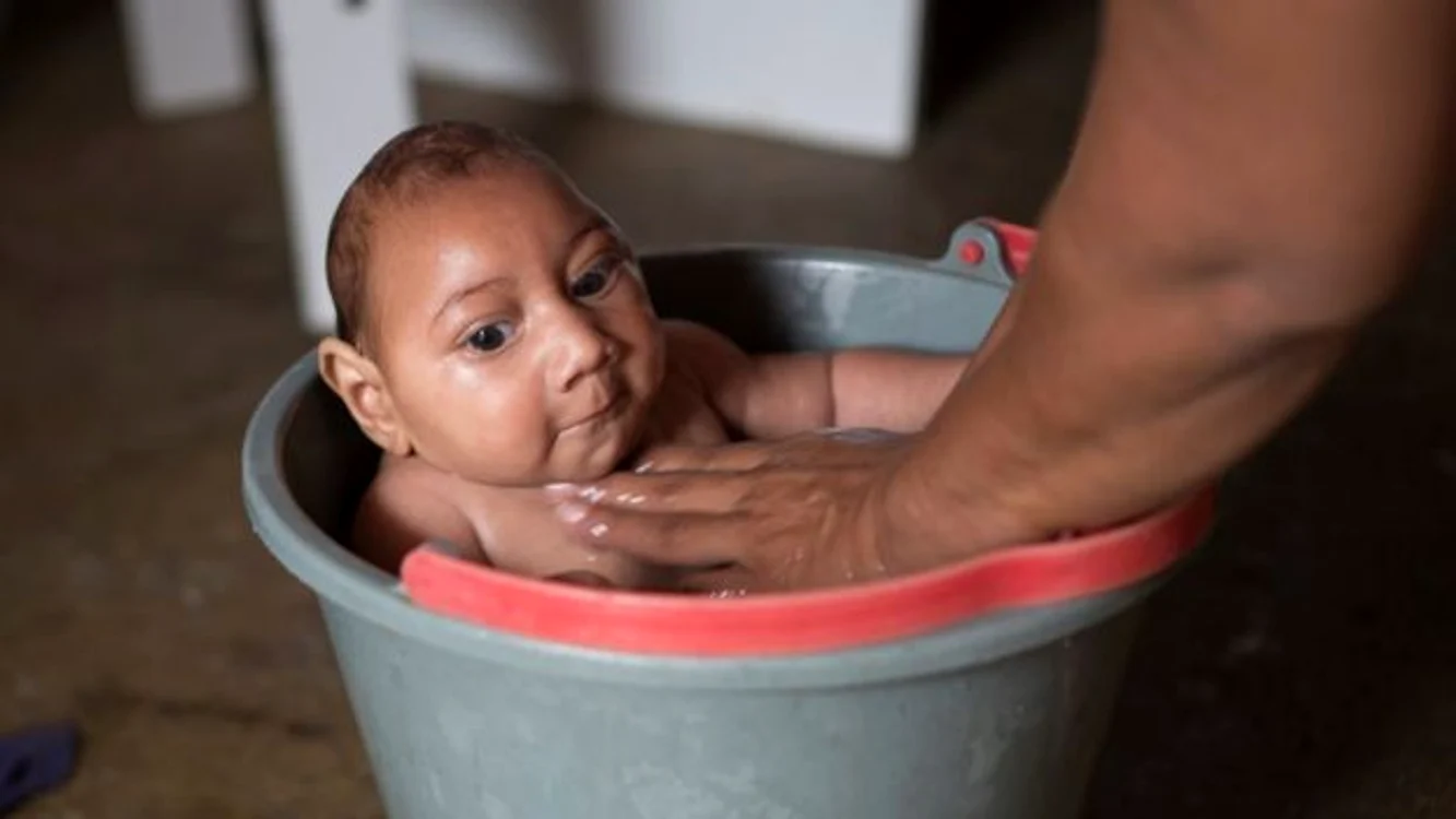 
    Virusul Zika ar putea fi răspunzător de cazurile de microcefalie la copii, în America Latină  