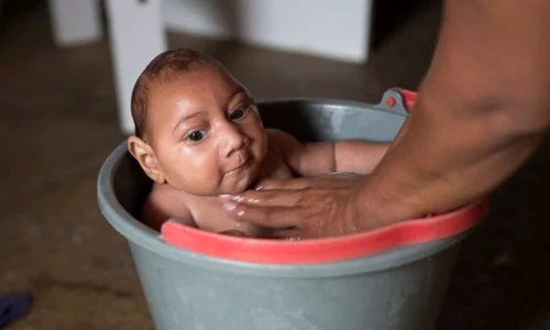 zika2 jpeg