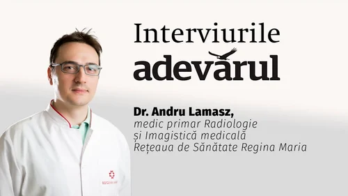 Tehnologia Low Dose disponibilă și în România mp4 thumbnail png