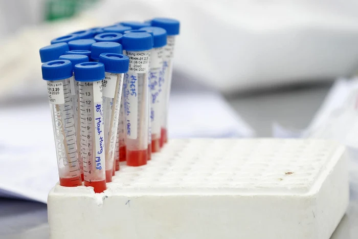 Din 7 iunie, atunci când s-a înregistrat cea mai mică valoare a cazurilor active, 4.444, acest indice a urcat constant, în ultima săptămână înregistrându-se aproape 1.900 de noi cazuri.