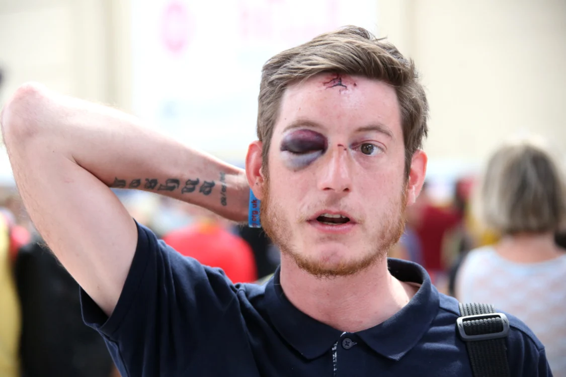 Martyn a fost bătut până a intrat în stare de inconștiență