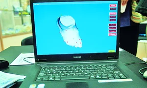 Aparatul scanează  fiecare picior  şi realizează  o „hartă” pe  care o vezi  pe ecranul  calculatorului jpeg