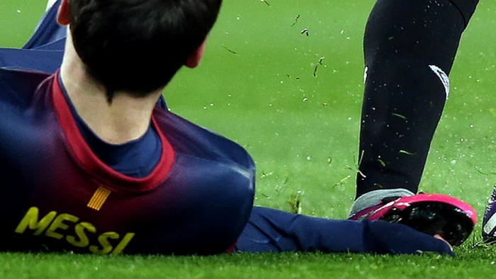 messi calcat pe mana