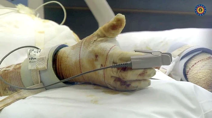 Pacientul are pulsul monitorizat