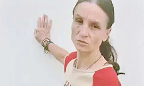 Andreea (34 de ani) are  echimoze în jurul ochilor jpeg