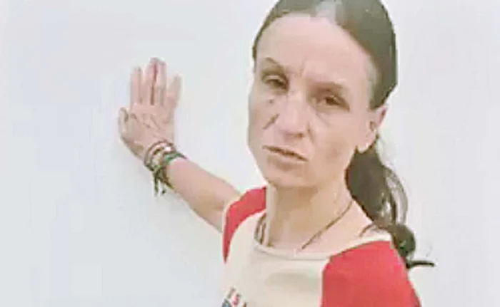 Andreea (34 de ani) are  echimoze în jurul ochilor