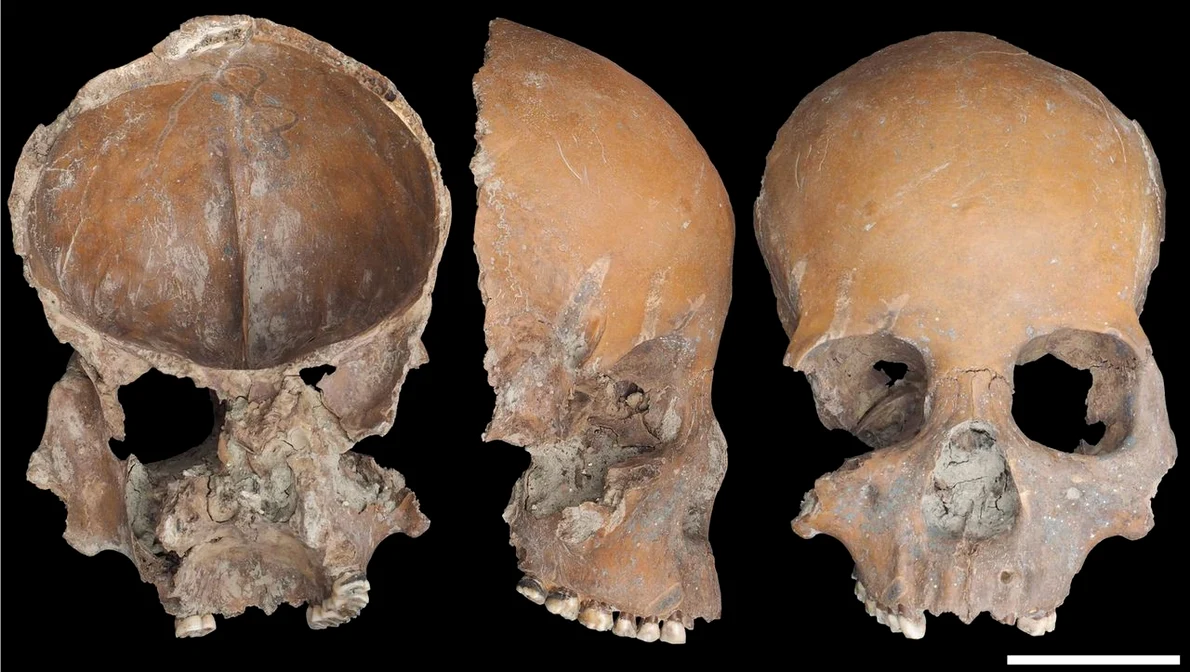 Foto: © Sawada et al., Scientific Reports (CC BY 4.0)