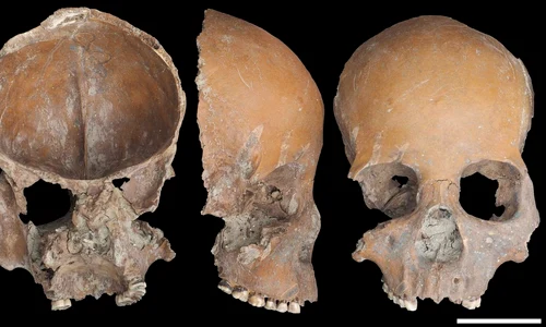 Foto: © Sawada et al., Scientific Reports (CC BY 4.0)