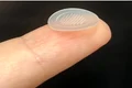 plasture acnee  jpg