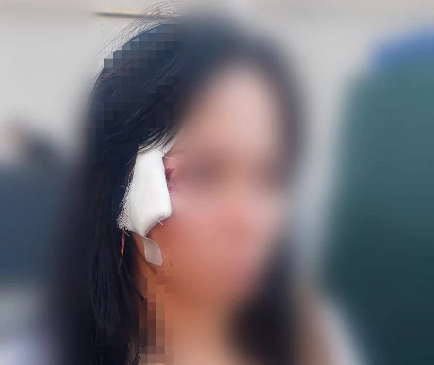 Una dintre victimele agresorului din tramvai. FOTO: Jandarmeria Capitalei