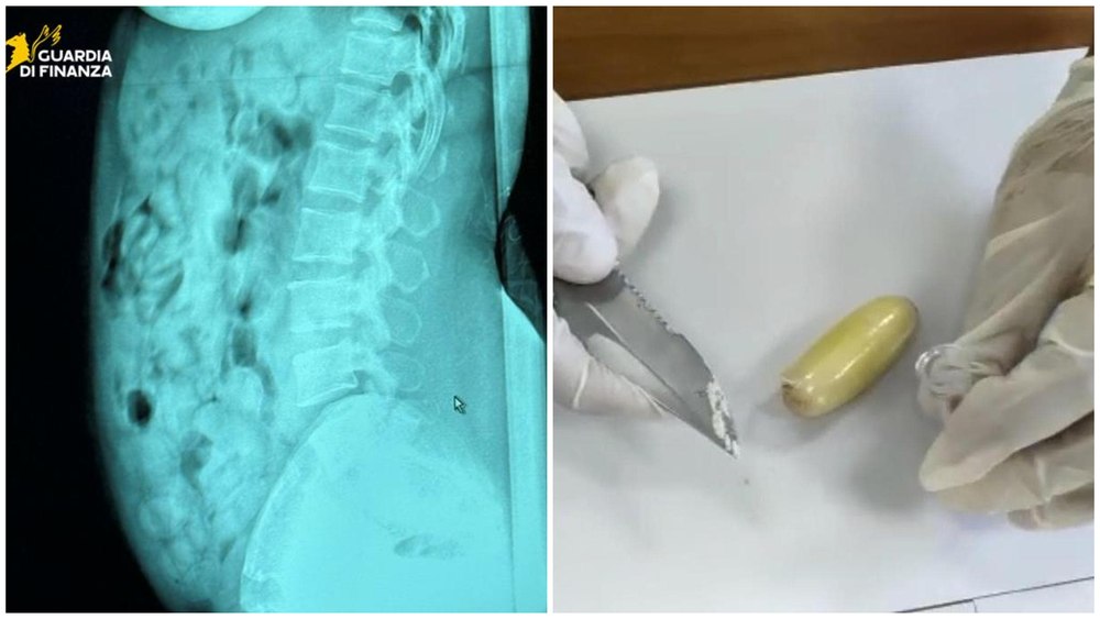 Româncă arestată pe un aeroport din Italia, după ce a fost prinsă cu 1,4 kg de droguri în stomac