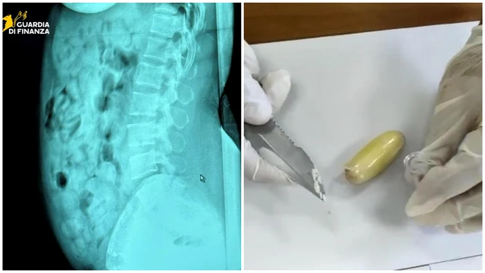  Femeia avea în stomac 120 de capsule de plastic pline cu droguri. FOTO: X/@rep_milano