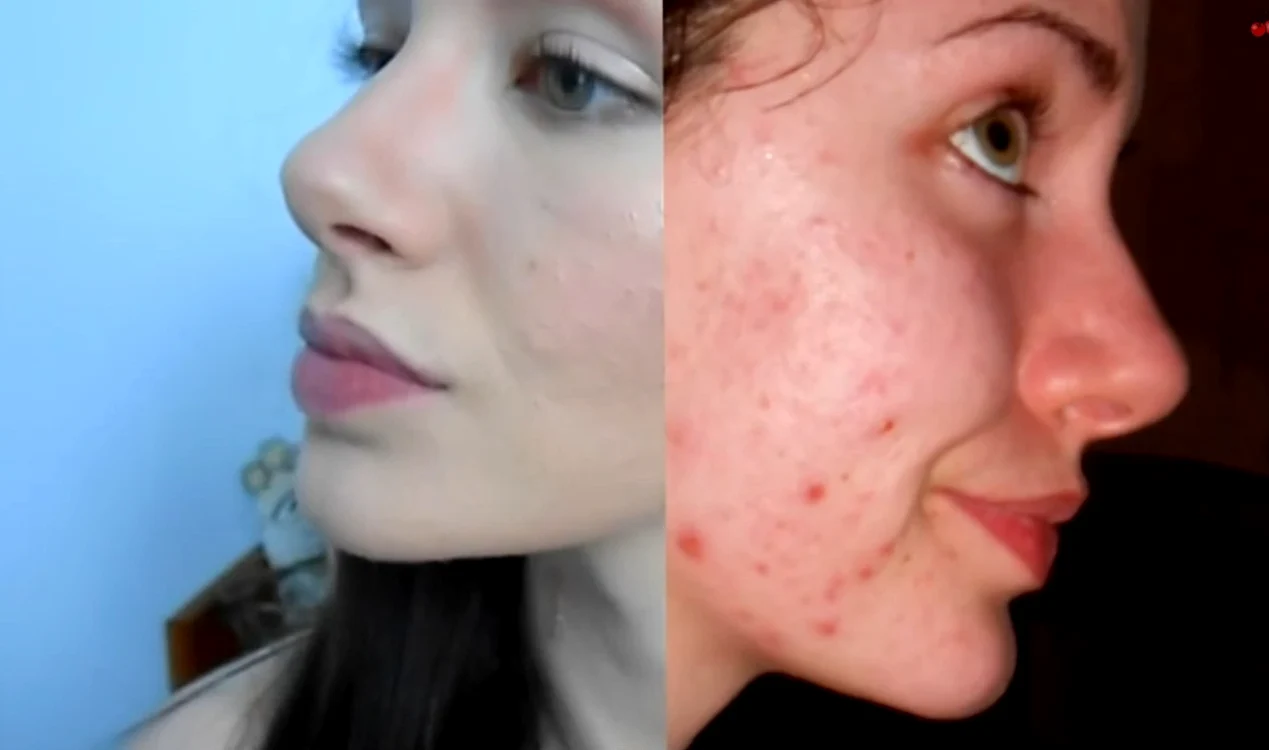 
    Melanie Murphy, înainte şi după machiaj  