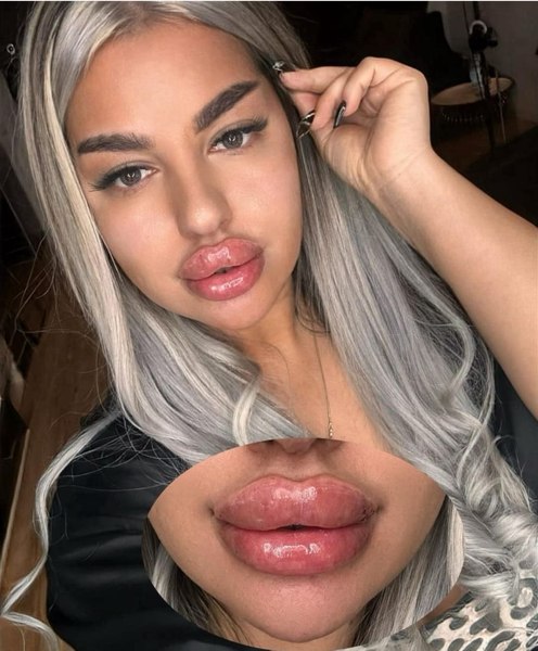 Clinică ilegală de estetică medicală din București, închisă de autorități. Cine făcea intervențiile chirurgicale FOTO UPDATE