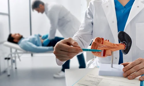 cancer pancreatic jpg