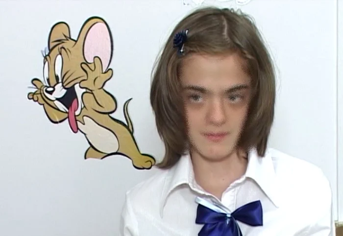Bianca a scăpat de cocoaşă şi este fericită că a mai crescut cu 15 cm.
