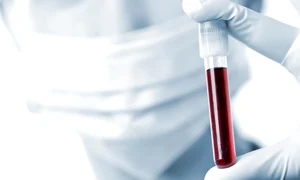 analize de sange jpeg