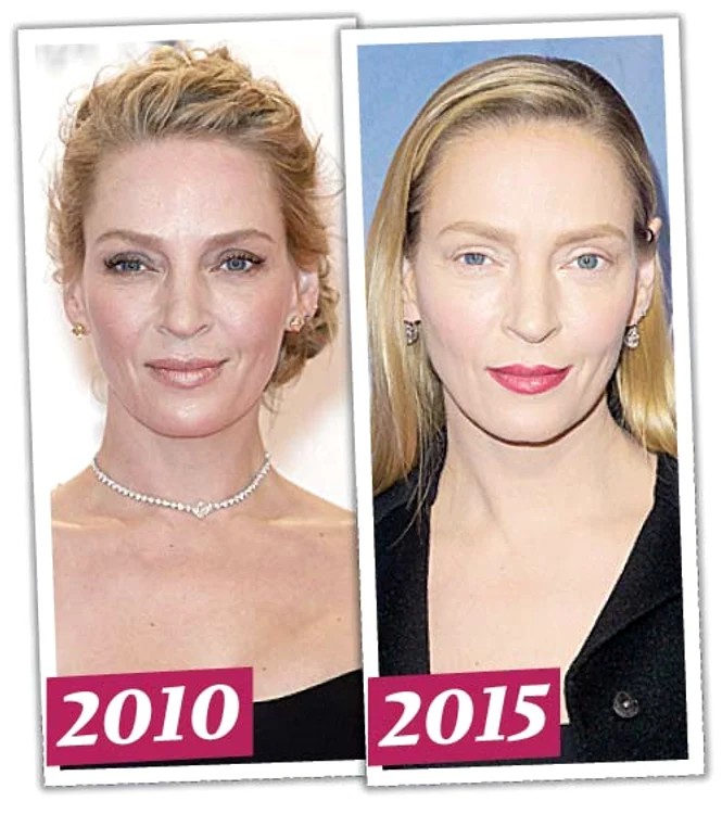 Actriţa, în vârstă de 61 de ani, este de nerecunoscut după ce şi-a făcut repetate injecţii cu botox