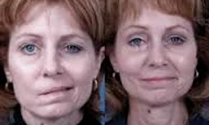 asimetria faciala copiisimamico ro  jpeg