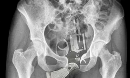 pistol vagin jpeg
