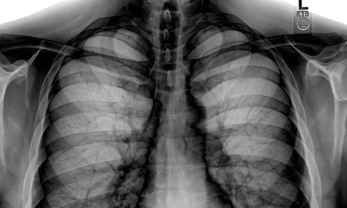 Imagistica medicală – „paznic“ sau „agresor“? jpeg
