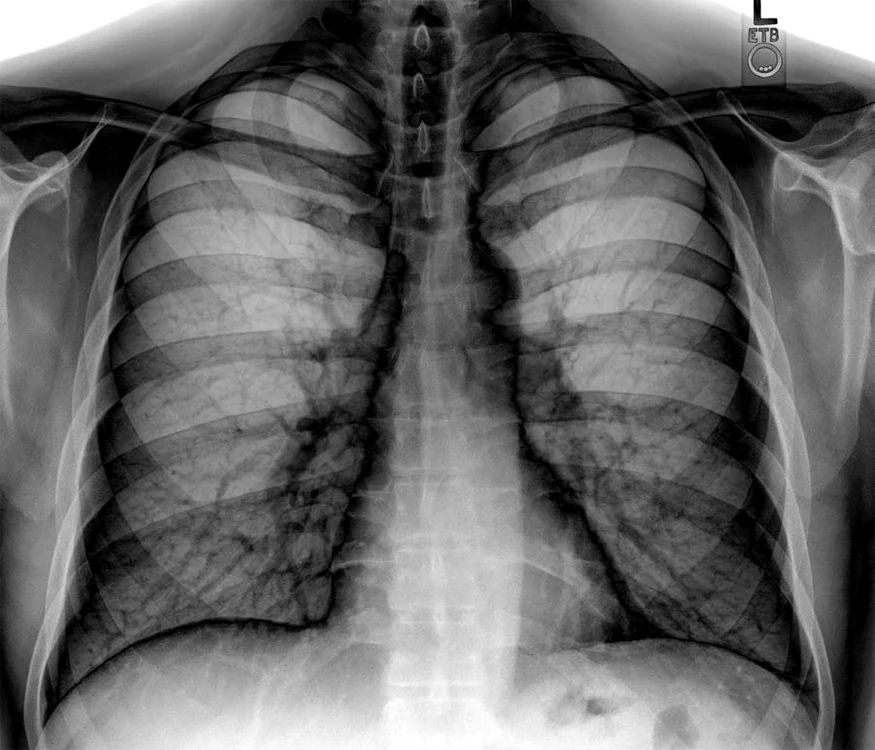 Imagistica medicală – „paznic“ sau „agresor“? jpeg
