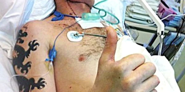 transplant fata