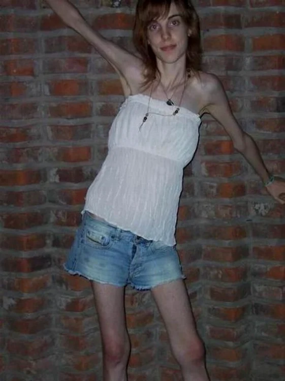 Anorexicele sunt sexy?