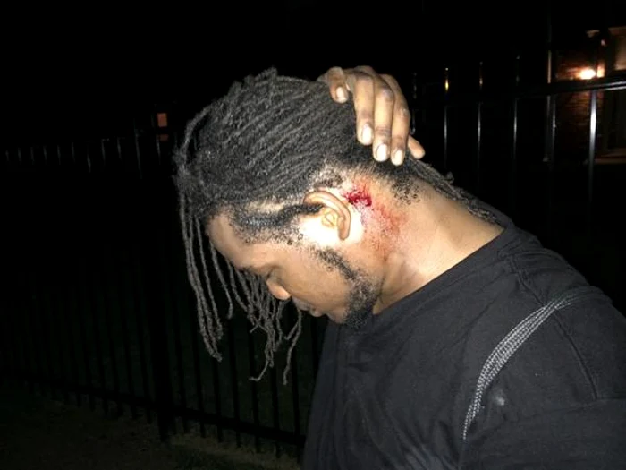 Un bărbat care protesta paşnic a fost rănit serios de poliţie