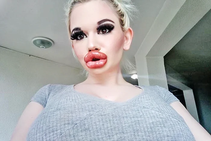 
    Înainte de intervenţii  