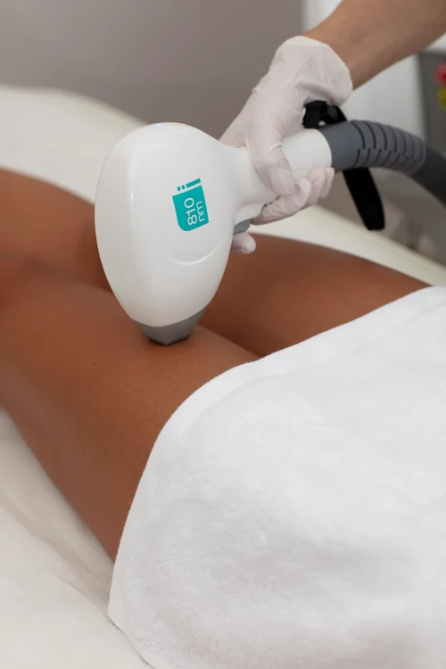 3 epilare definitiva skinmedspa jpg jpeg