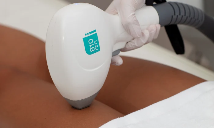 3 epilare definitiva skinmedspa jpg jpeg