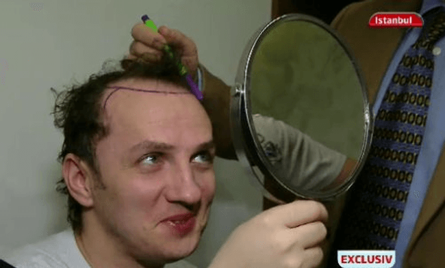 Content image