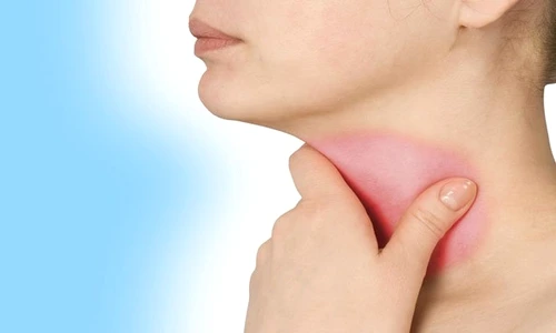 1 83998 original jpg jpeg