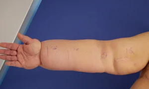 1 premiera medicala clinica zetta jpg jpeg