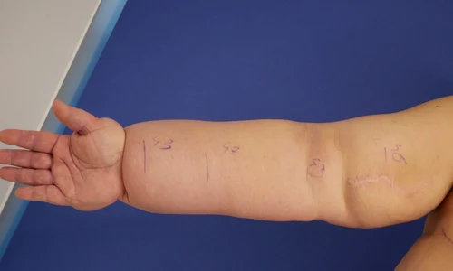 1 premiera medicala clinica zetta jpg jpeg