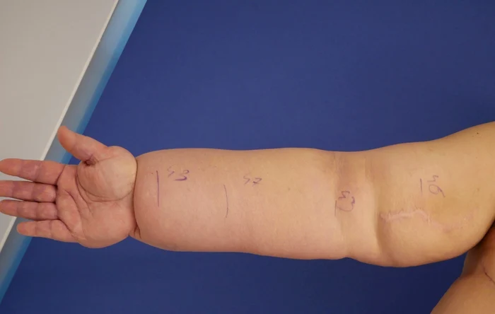 1 premiera medicala clinica zetta jpg jpeg