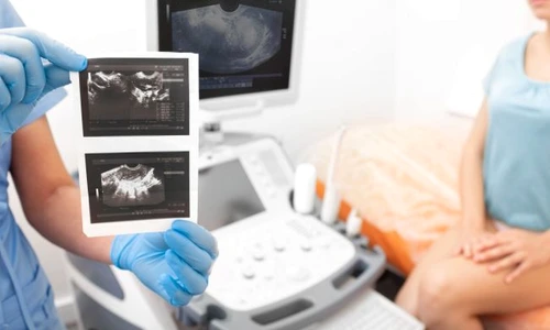 1 ecografie trans jpg jpeg