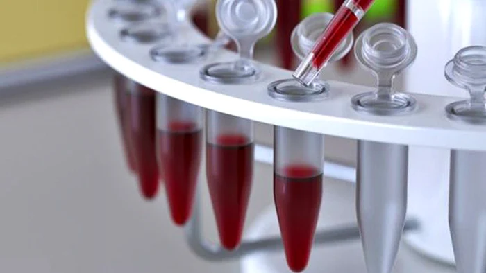 Un test de sânge ar putea detecta primele semne de cancer. Oncolog: „Este incredibil”