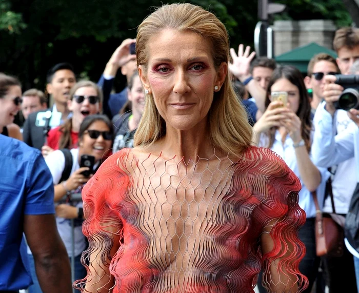 
    Celine Dion slăbește văzând cu ochiifoto: Profimedia  