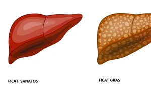 Ficatul gras este o problemă de sănătate jpeg