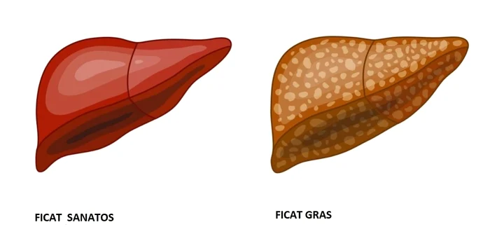 
    Ficatul gras este o problemă de sănătatefoto: captura Facebook  