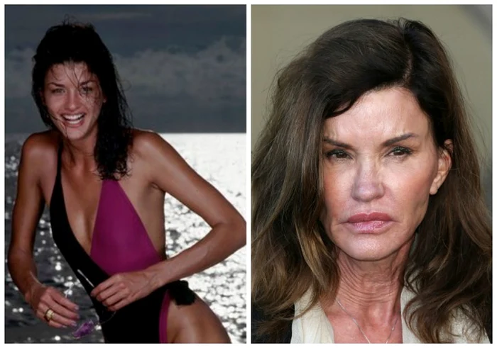 Janice Dickinson, înainte și după operațiile esteticefoto: Arhiva personală