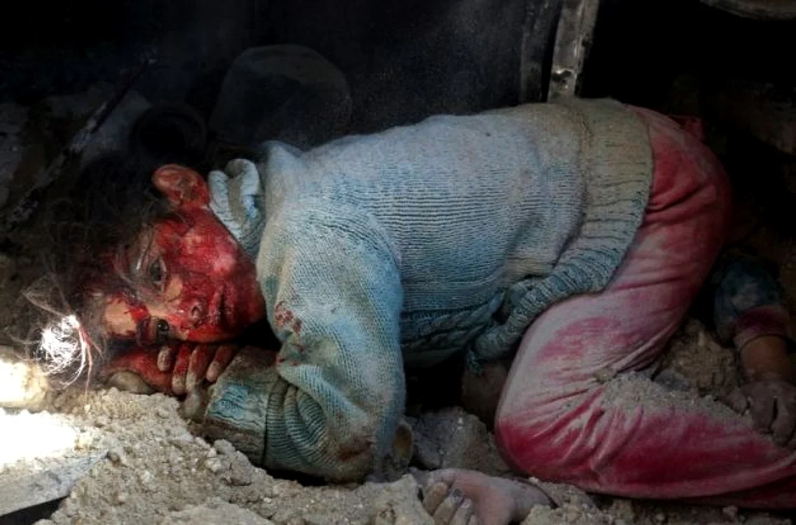 Fetiţă rănită - Khan Sheikhun / FOTO AFP