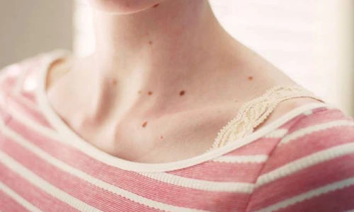 1 70316 original jpg jpeg