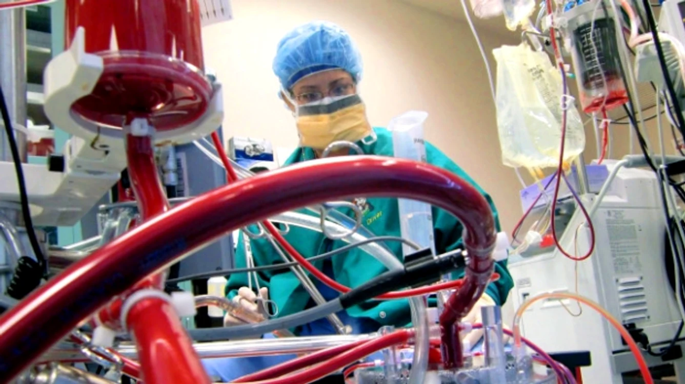 Plămânul artificial preia funcția organului pacientului
