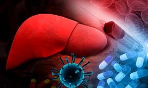 ficat 47357966 xxl jpeg