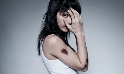 cum scapi de vânătăi jpeg