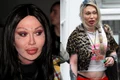 pete burns operatii estetice jpeg