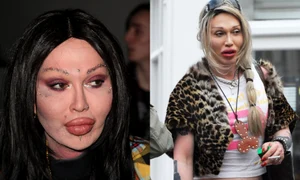 pete burns operatii estetice jpeg